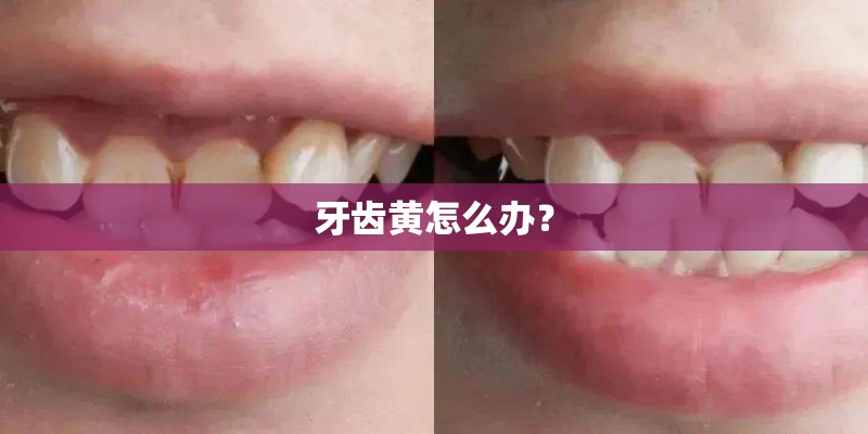 青海雪莲的栽培要点