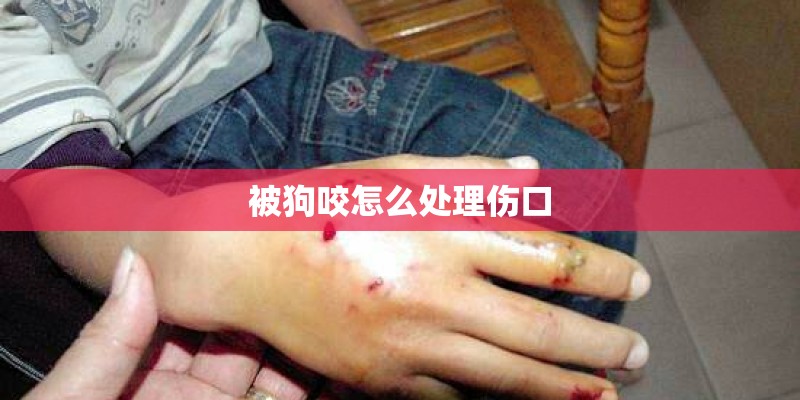 被狗咬怎么处理伤口