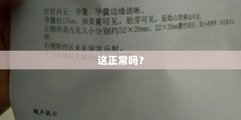 这正常吗？