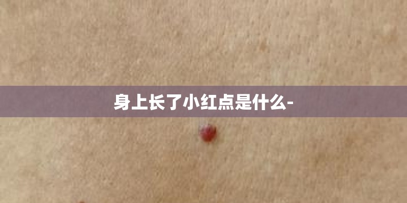身上长了小红点是什么-
