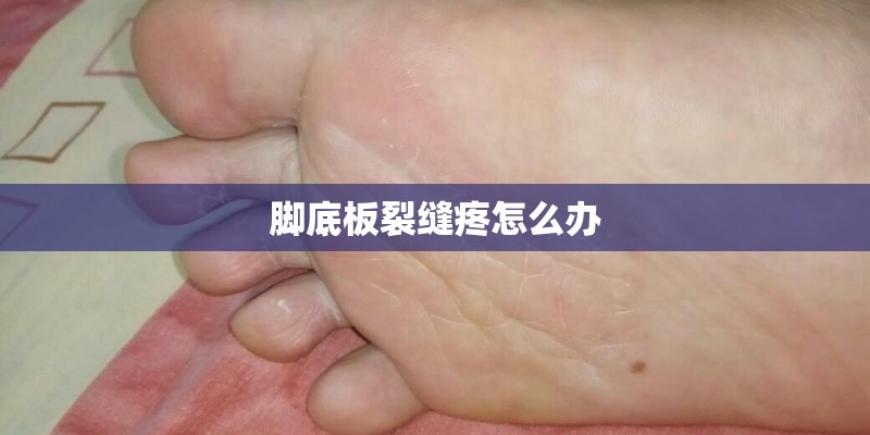 脚底板裂缝疼怎么办