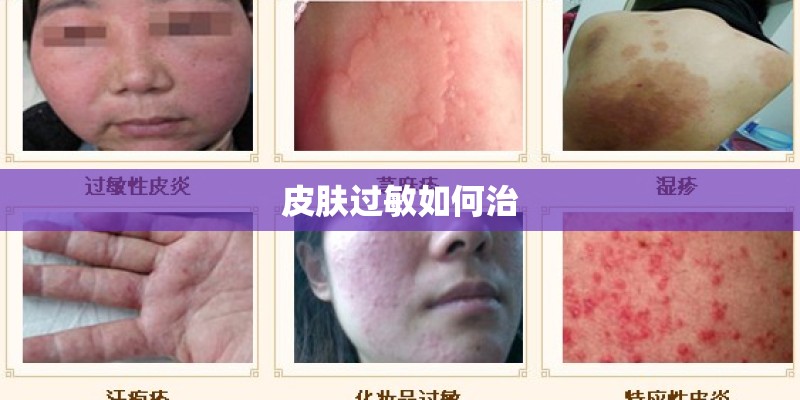 皮肤过敏如何治