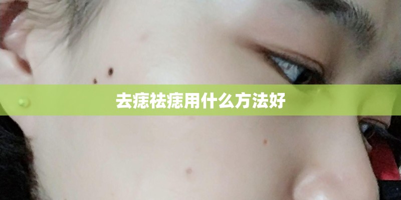 去痣祛痣用什么方法好