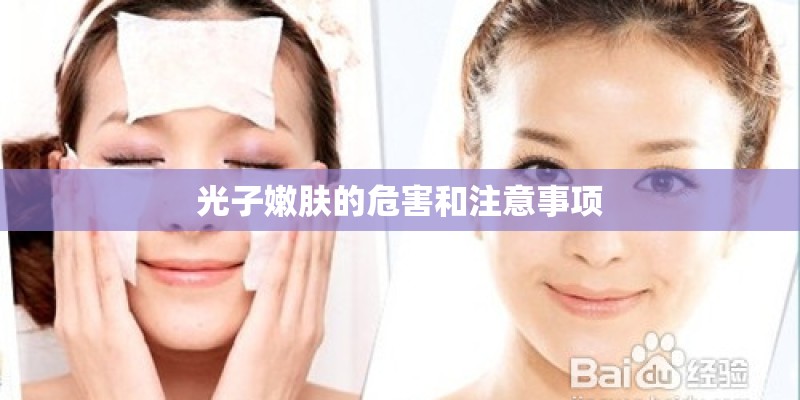 光子嫩肤的危害和注意事项