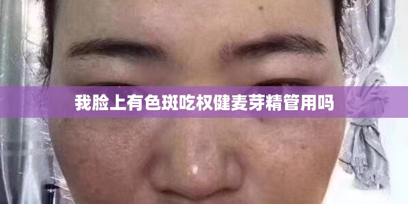 我脸上有色斑吃权健麦芽精管用吗