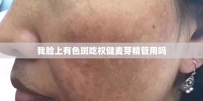 我脸上有色斑吃权健麦芽精管用吗